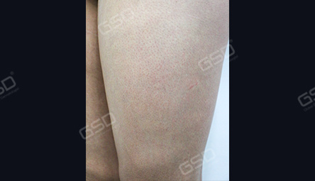 Диодный лазер COOLITE BOLT 1800W фото 7