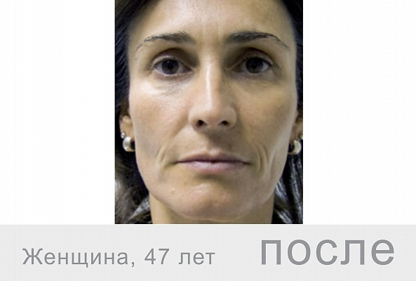 F-XFC+ Полиревитализирующий комплекс (63 компонента), 5мл фото 4