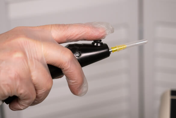 Аппарат инъекционной карбокситерапии "Карбоксика" (мобильная версия) фото 6